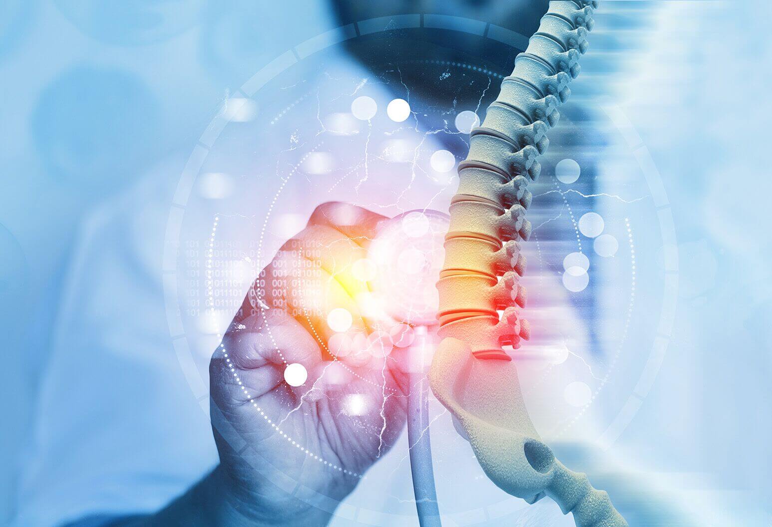 تومور های نخاعی